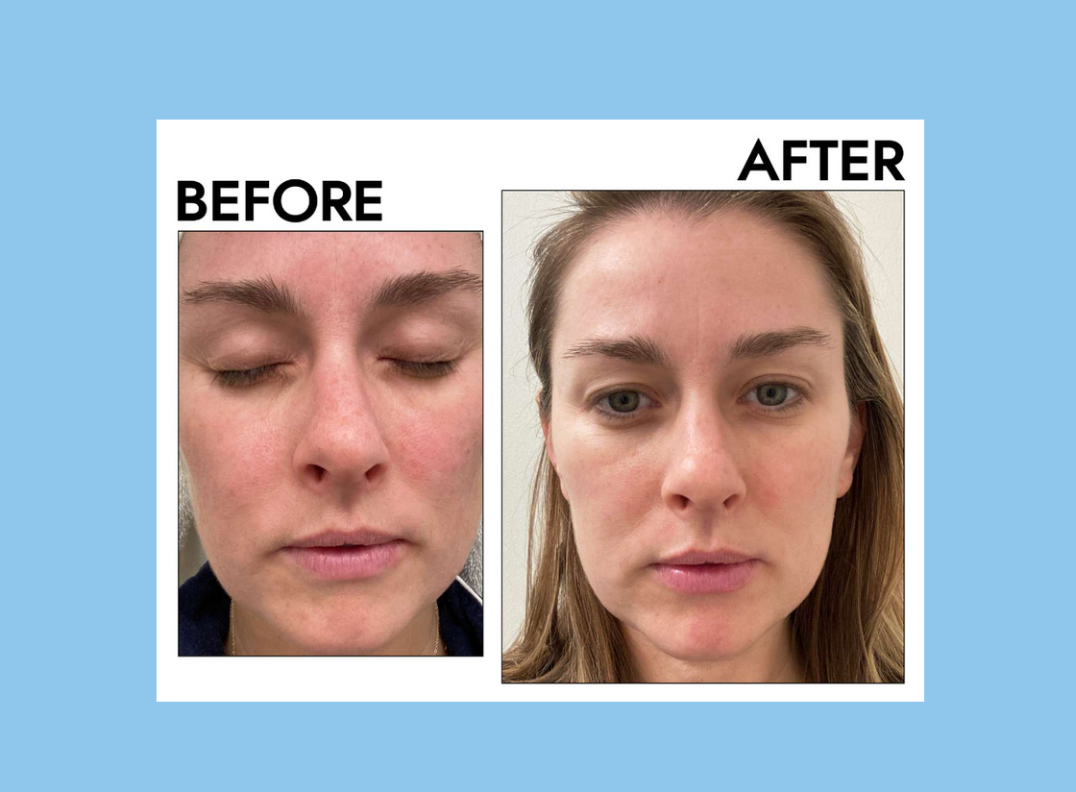 Manhattan Ice - Ice Guasha