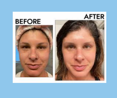 Manhattan Ice - Ice Guasha