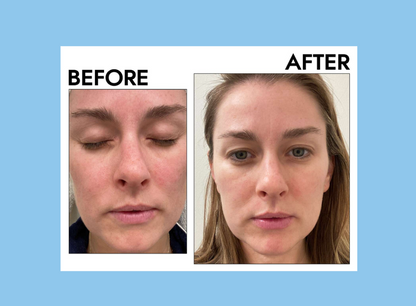 Manhattan Ice - Ice Guasha