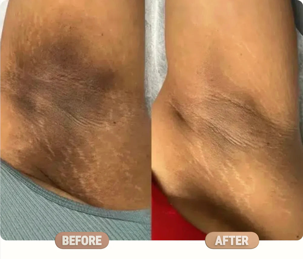 Manhattan Ice Kojic Acid Spray + Free Gift