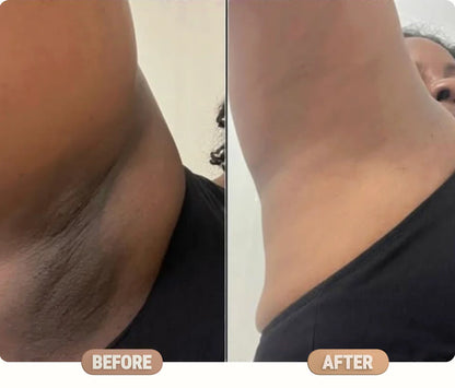 Manhattan Ice Kojic Acid Spray + Free Gift