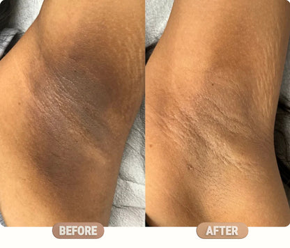 Manhattan Ice Kojic Acid Spray + Free Gift