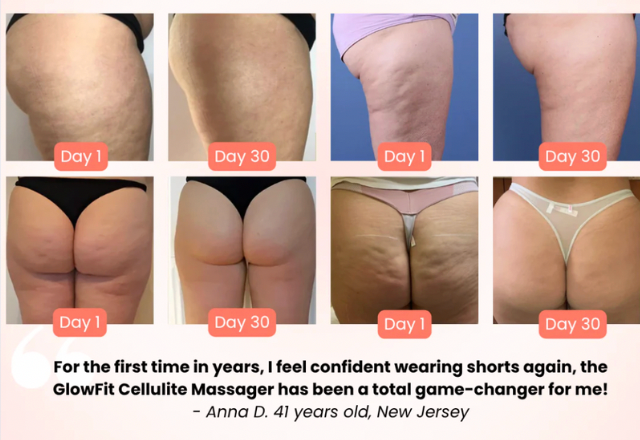 Manhattan Ice™️ Cellulite Therapy Wand