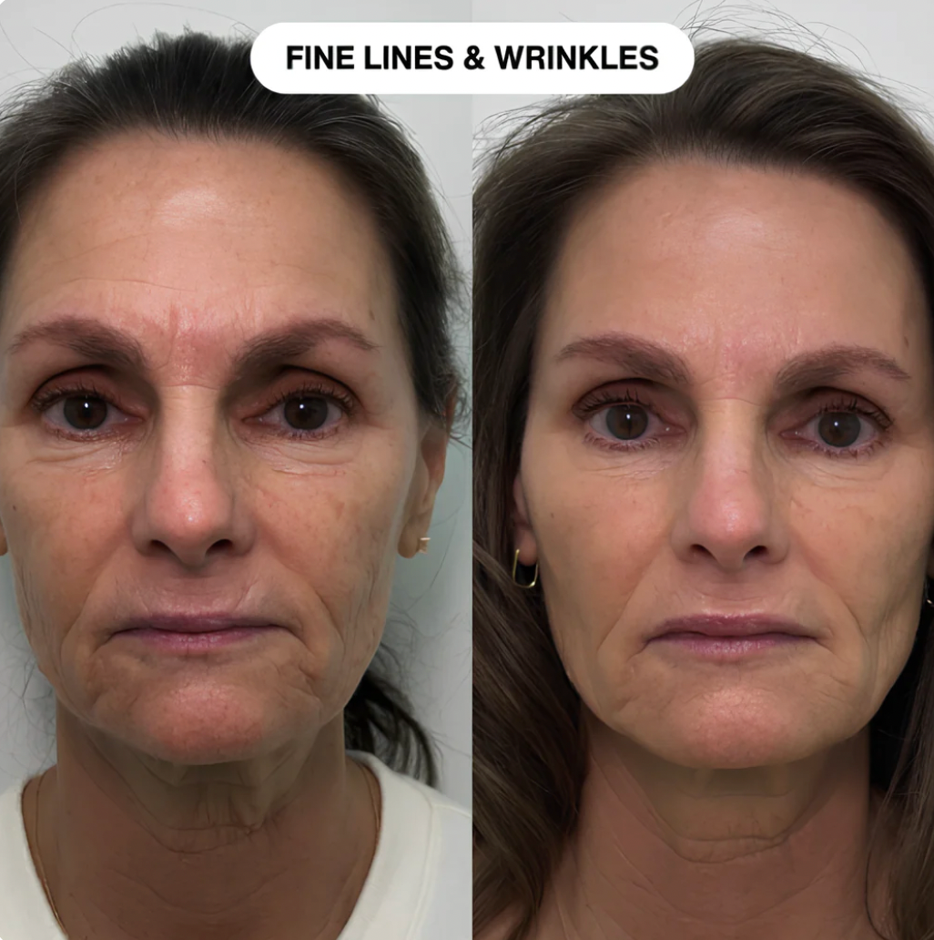 Manhattan Ice™️ Line Erasing Wonder Serum