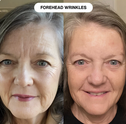 Manhattan Ice™️ Line Erasing Wonder Serum