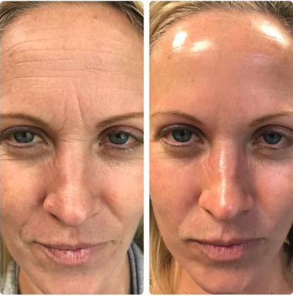 Manhattan Ice™️ Line Erasing Wonder Serum