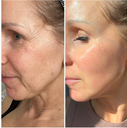 Manhattan Ice™️ Line Erasing Wonder Serum