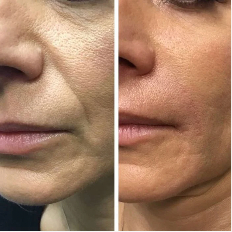 Manhattan Ice™️ Line Erasing Wonder Serum