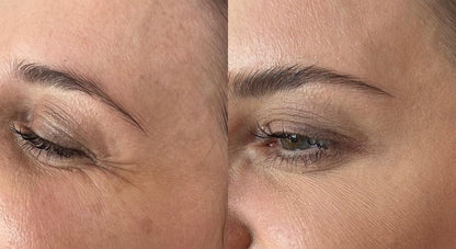 Manhattan Ice - K Beauty Micro Needle Under Eye Patches